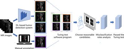 Evaluation of Deep Learning-Based Automated Detection of Primary Spine Tumors on MRI Using the Turing Test